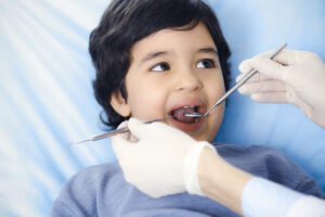 Narrow Palate Treatment for Children in Los Angeles, CA