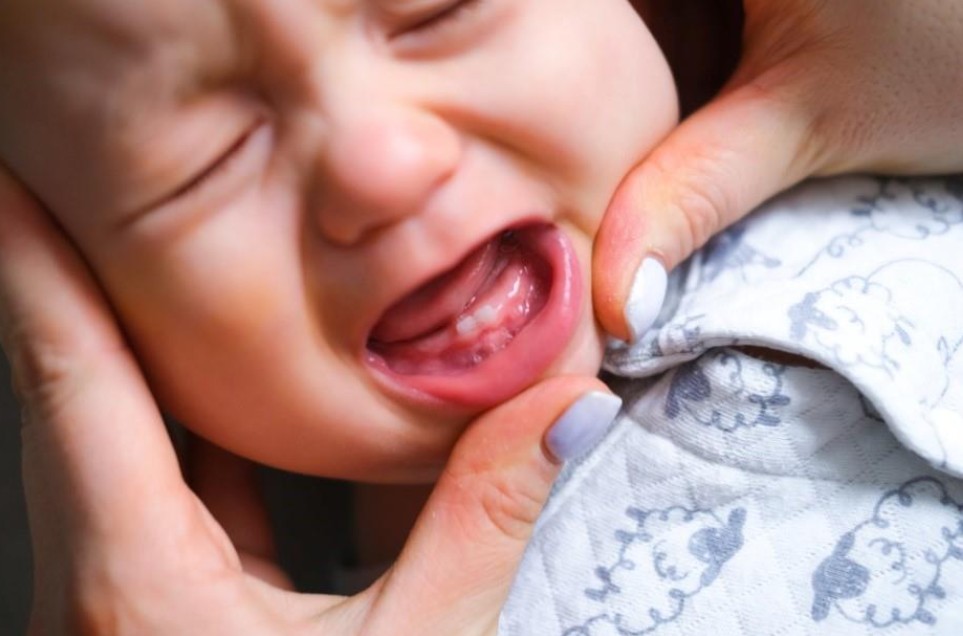 First Tooth, First Threat: Preventing Early Childhood Caries (ECC)